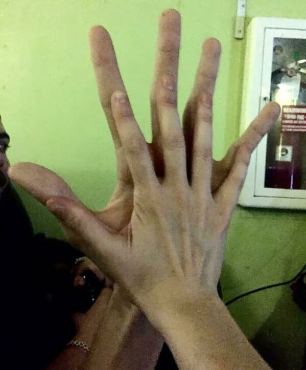 “The Size Of My Hand Versus My Friend’s Hand”