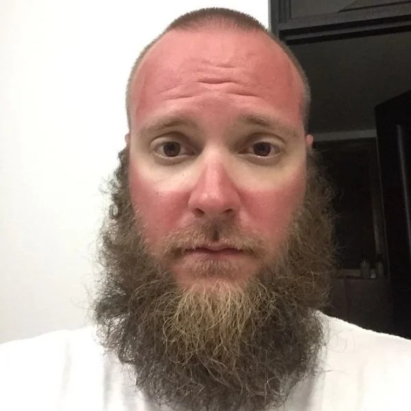 23 Sunburns From Hell.