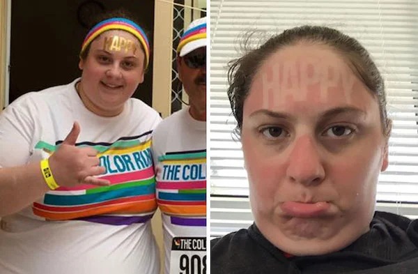 23 Sunburns From Hell.