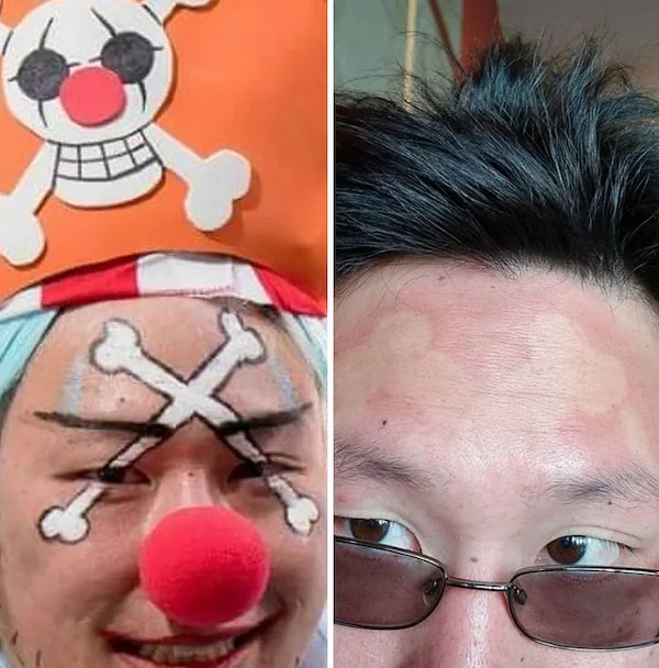 23 Sunburns From Hell.