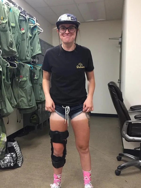 23 Sunburns From Hell.