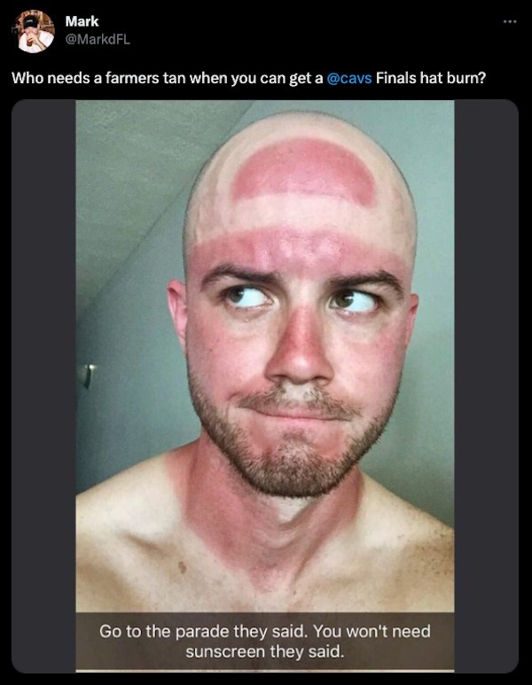 23 Sunburns From Hell.