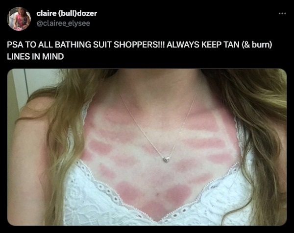 23 Sunburns From Hell.