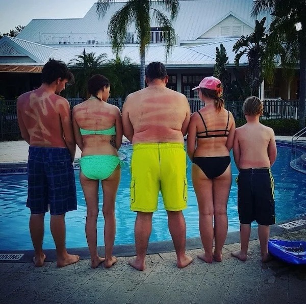 23 Sunburns From Hell.