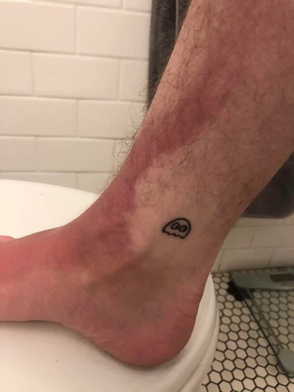 23 Sunburns From Hell.