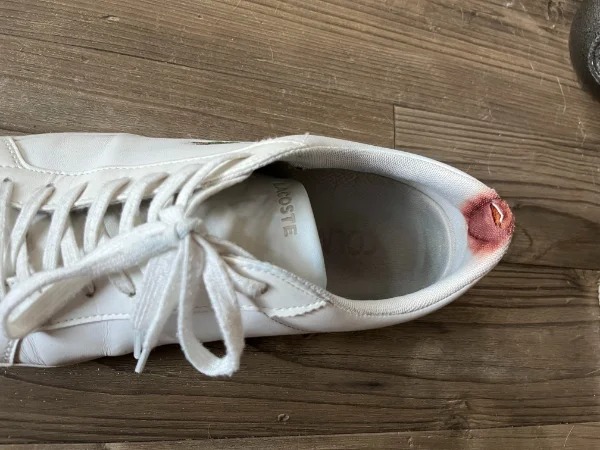“My shoe attacked me and I didn’t notice until after work”