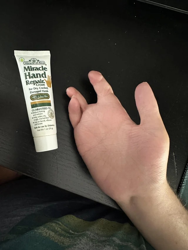 relatabe memes - hand - Miracle of Aloe Miracle Hand Repair For Dry, Cracked, Damaged Hands 60% Ultra Ale Guaranteed To Reduce flaking and redness Help soften dr rough cracked s Use on hands, elbows and knees Sale for use by Diabeto Net W 1 or 25g Sve 2 4