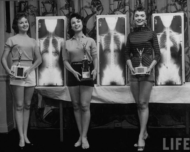 The winners of the Miss Perfect Posture contest at a chiropractors convention. [1956]