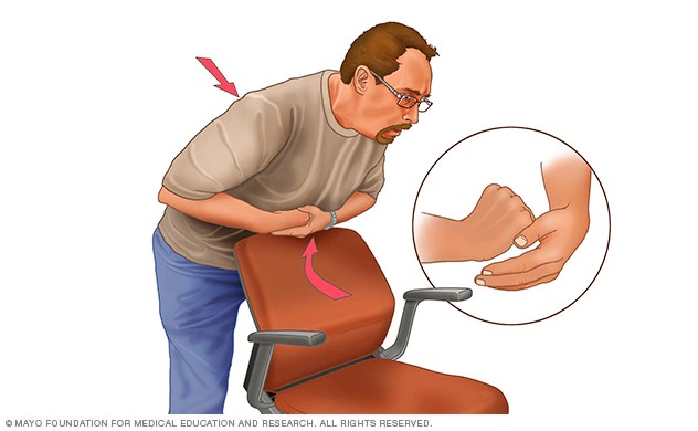 A chair can be used to Heimlich maneuver yourself.