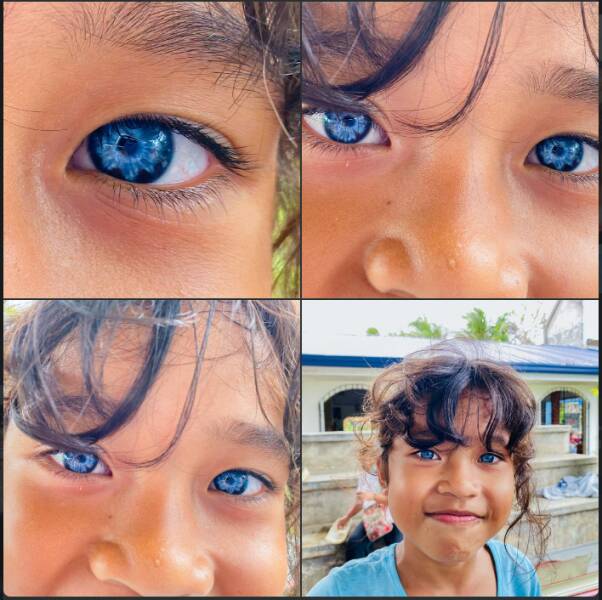 mildly interesting pics - Girl in the Philippines has a genetic mutation of blue eyes
