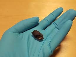Some of the first chewing gums, made of birch tar and other natural substances, have been preserved for thousands of years, including a 5,700-year-old piece of Stone Age gum unearthed in Denmark.