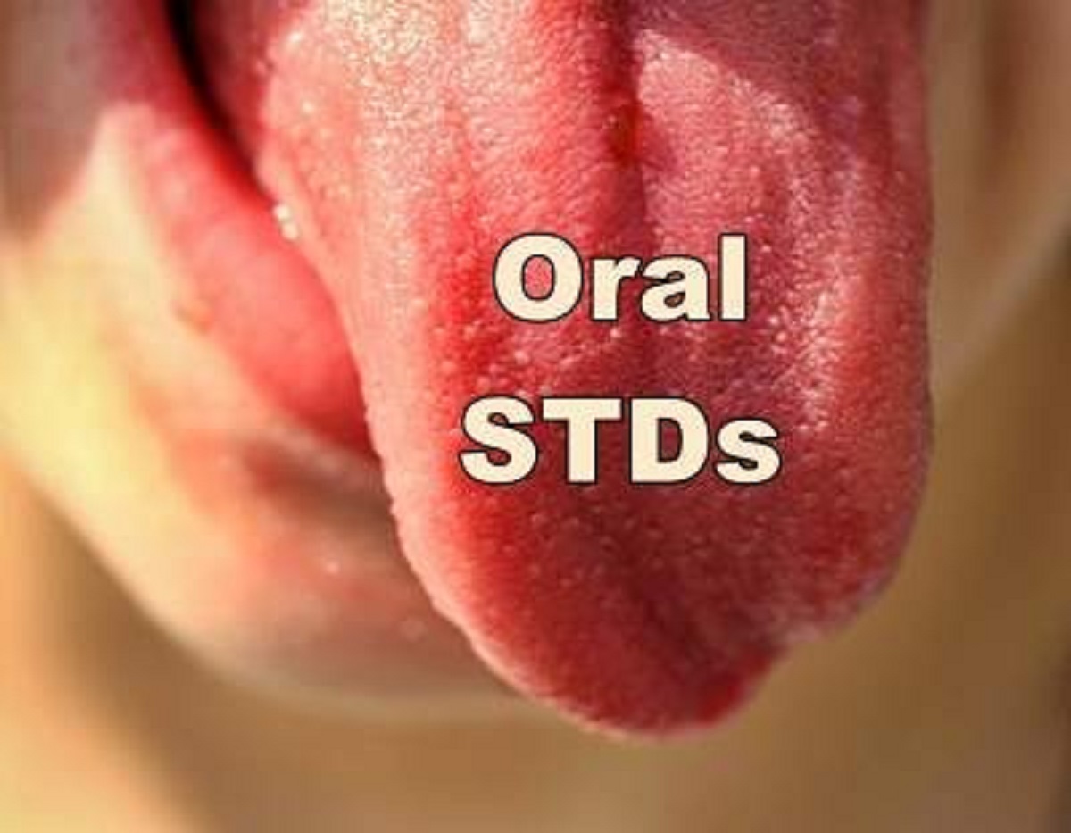 "You can't get STDs from oral sex"

One of the clinics I work at is a free sexual health clinic. Too many women are in there for mouth/throat/other digestive problems stemming from unprotected oral sex and various STDs.