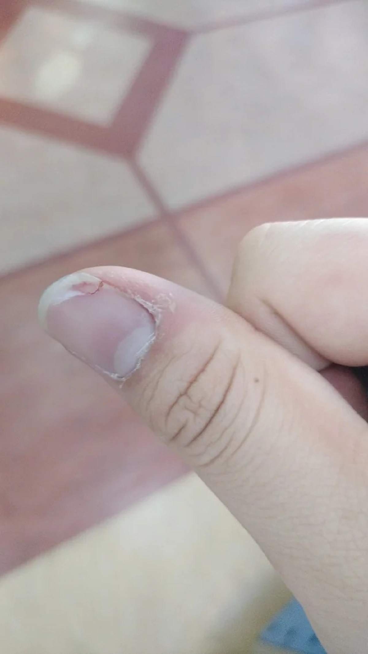 The nail of my thumb while playing bowling