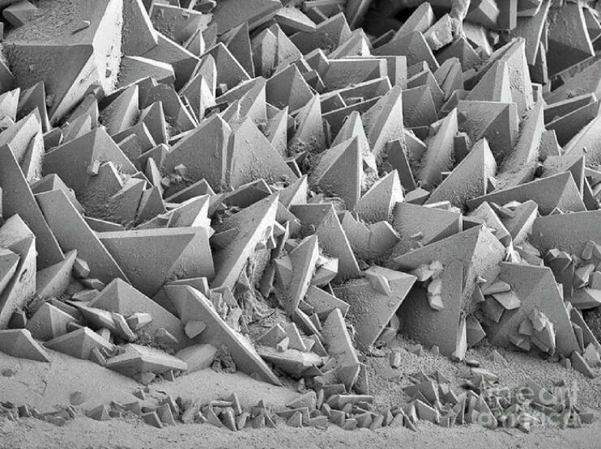 viral pics - kidney stone electron microscope