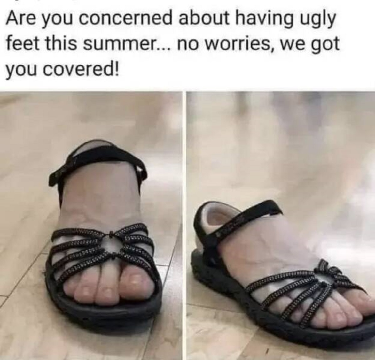 ugly feet in sandals meme - Are you concerned about having ugly feet this summer... no worries, we got you covered!