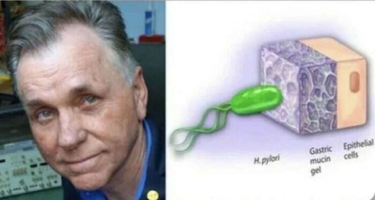 "Barry Marshall Was Convinced That The Helicobacter Pylori Bacteria Caused Stomach Ulcers, But No One Believed Him"

"Since it was illegal to test his theory on humans, he drank the bacteria himself and developed ulcers within days.

He treated them with antibiotics and we on to win a Nobel prize in 2005."