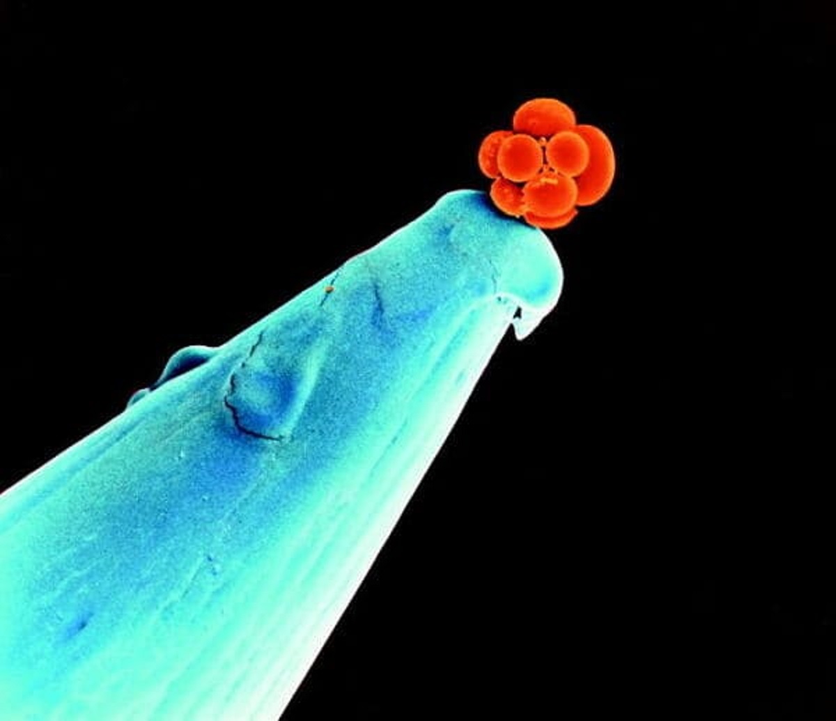 “An Early Human Embryo On The Tip Of A Needle”