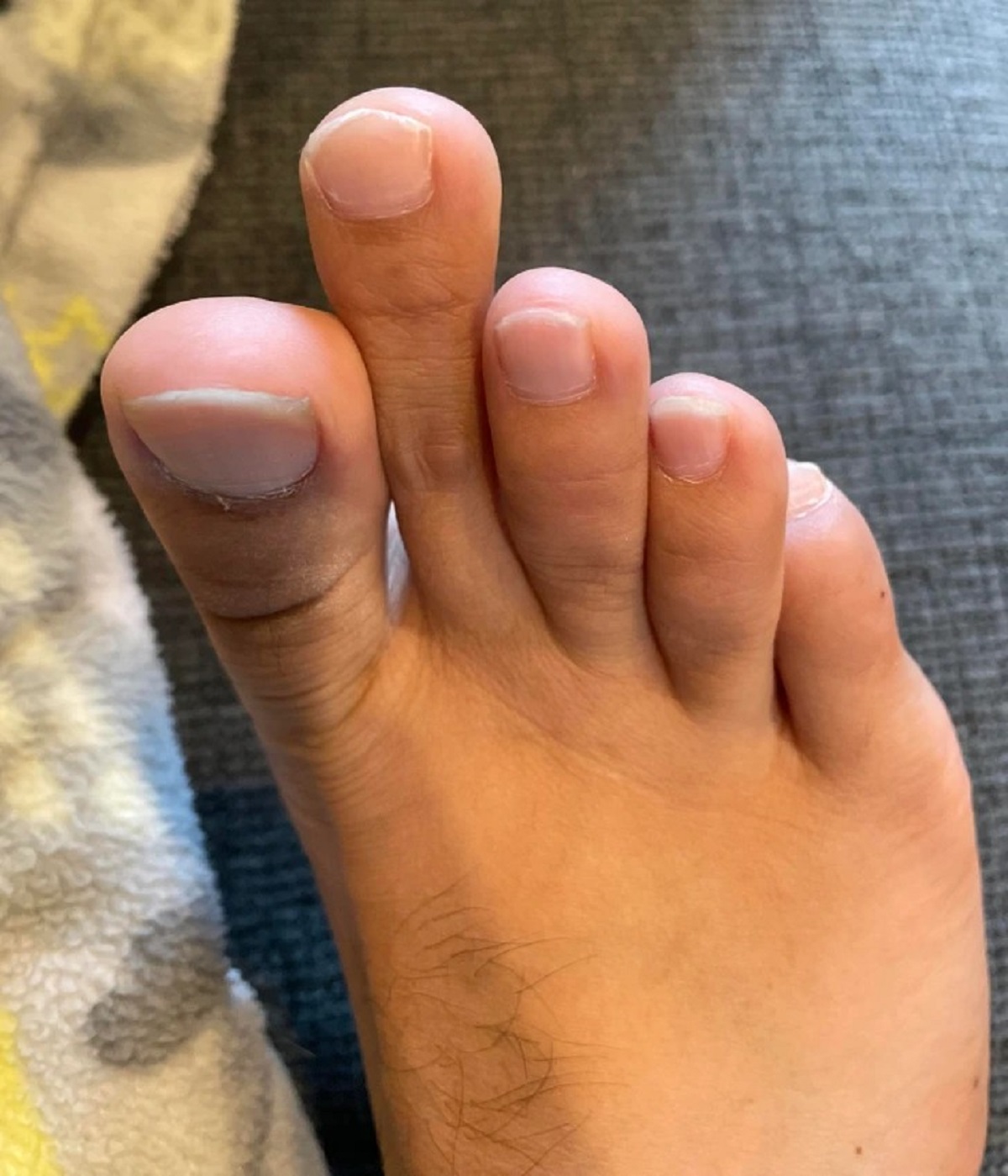 “My second toe is a lot longer than the rest of my foot.”