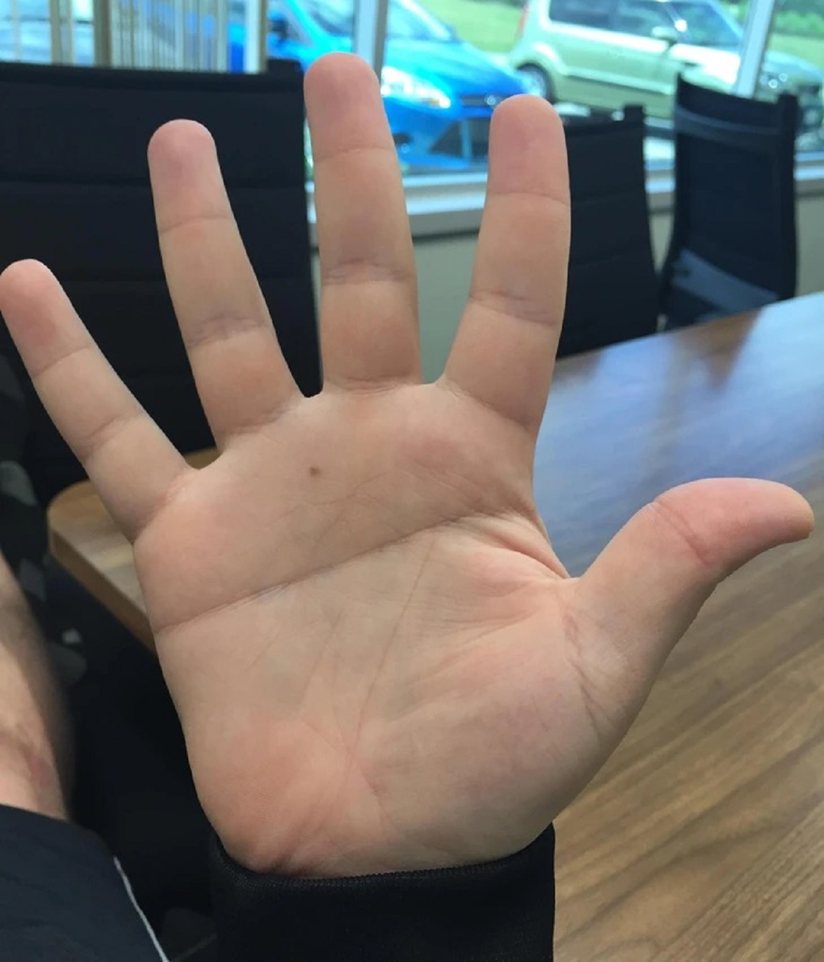 “I have a single line across my palm.”