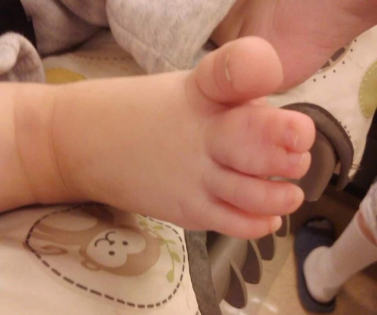 This baby’s signature webbed toes