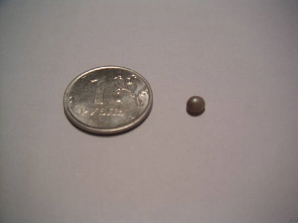 “I had mussels for dinner. This is what I found by almost breaking my tooth. It’s a real pearl!”