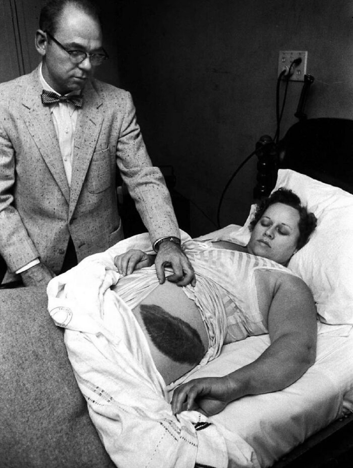 Ann Hodges shows off her bruise after being hit by a meteorite, 1954.

In Sylacauga, Alabama in 1954, Ann Hodges was napping on her couch, when a softball-size hunk of black rock broke through the ceiling, bounced off her radio console, and hit her in the thigh, leaving a very large bruise.

A geologist working in the area was called to the scene and determined the object was a meteorite weighing 8.5 pounds and measuring seven inches in length.

Ann Elizabeth Hodges is the first documented case of a human struck by a meteorite.