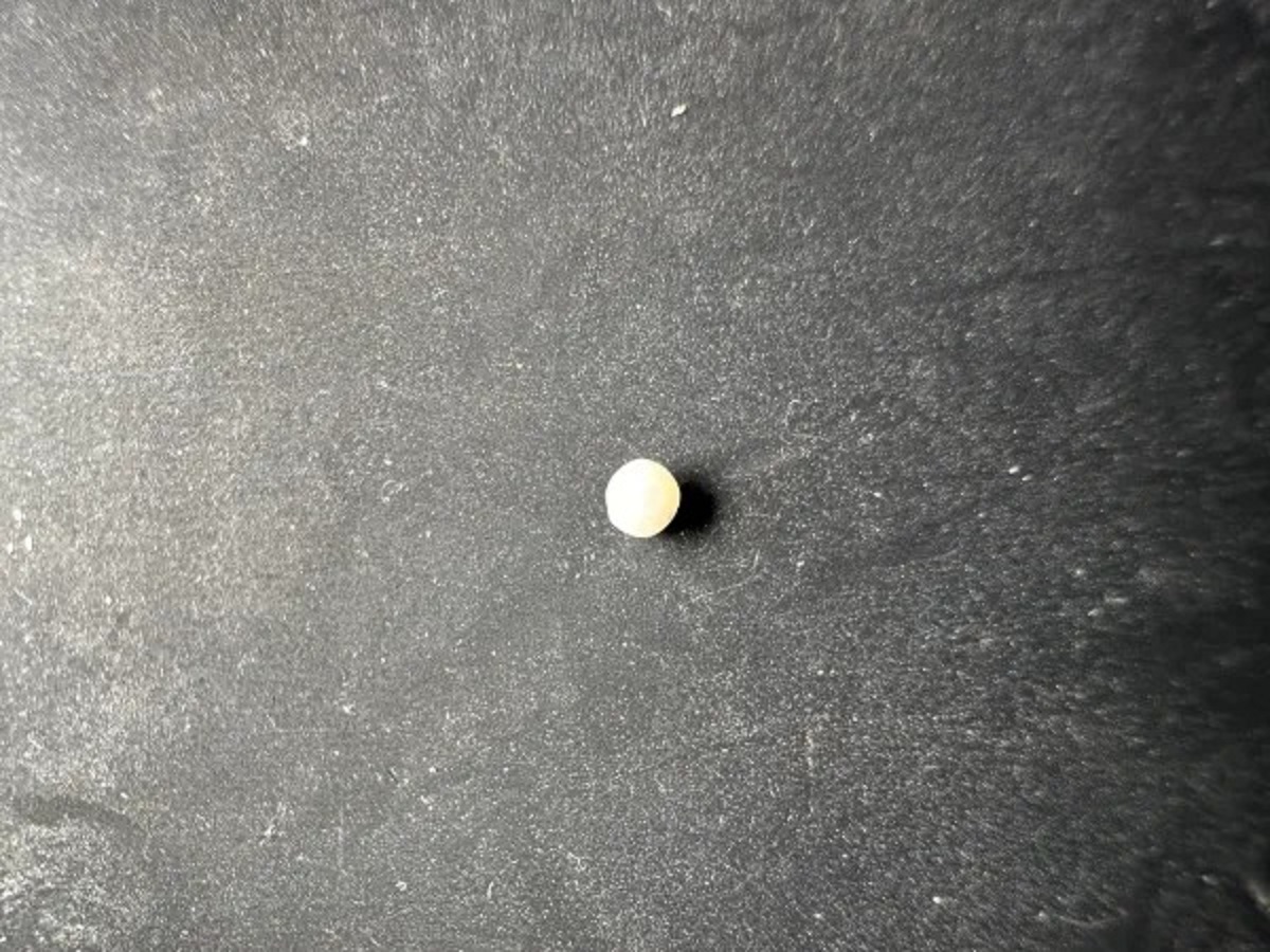 “I was eating a mussel (definitely not an oyster) and cracked my tooth on this. I think it might be a pearl”