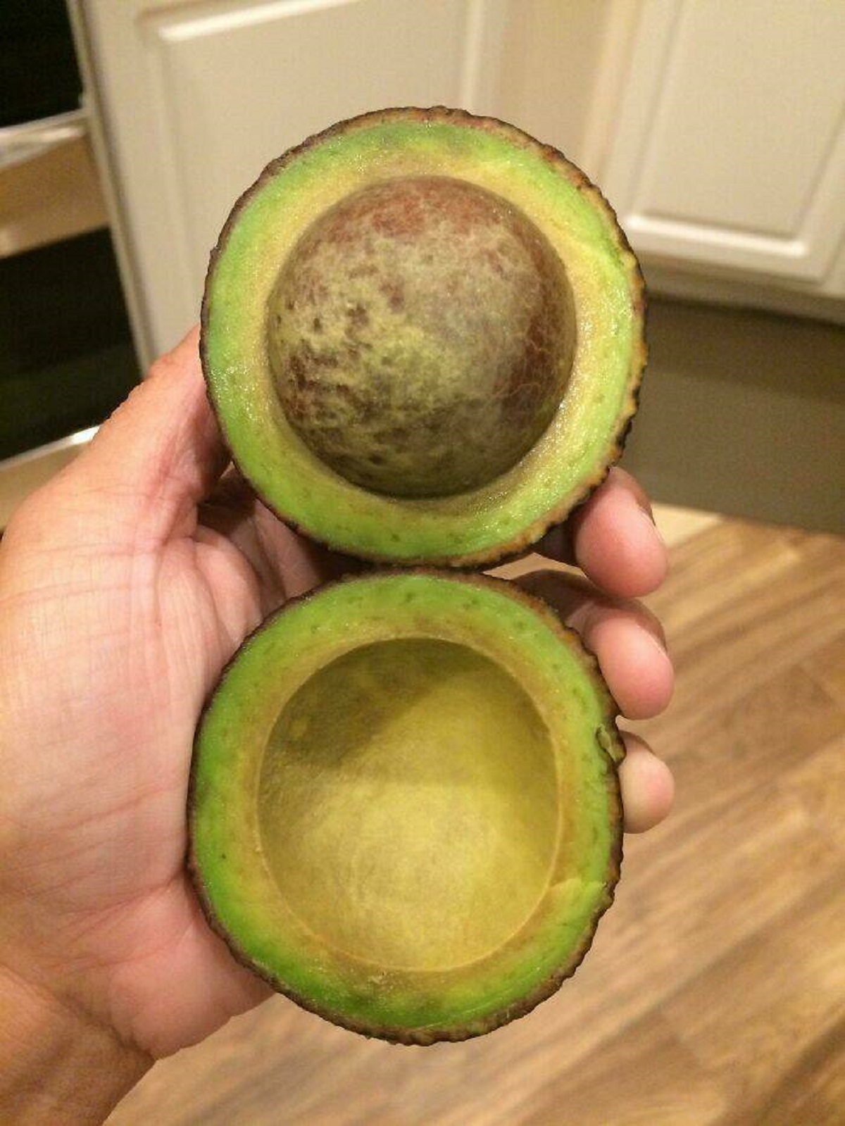 "I Lost The Avocado Lottery"