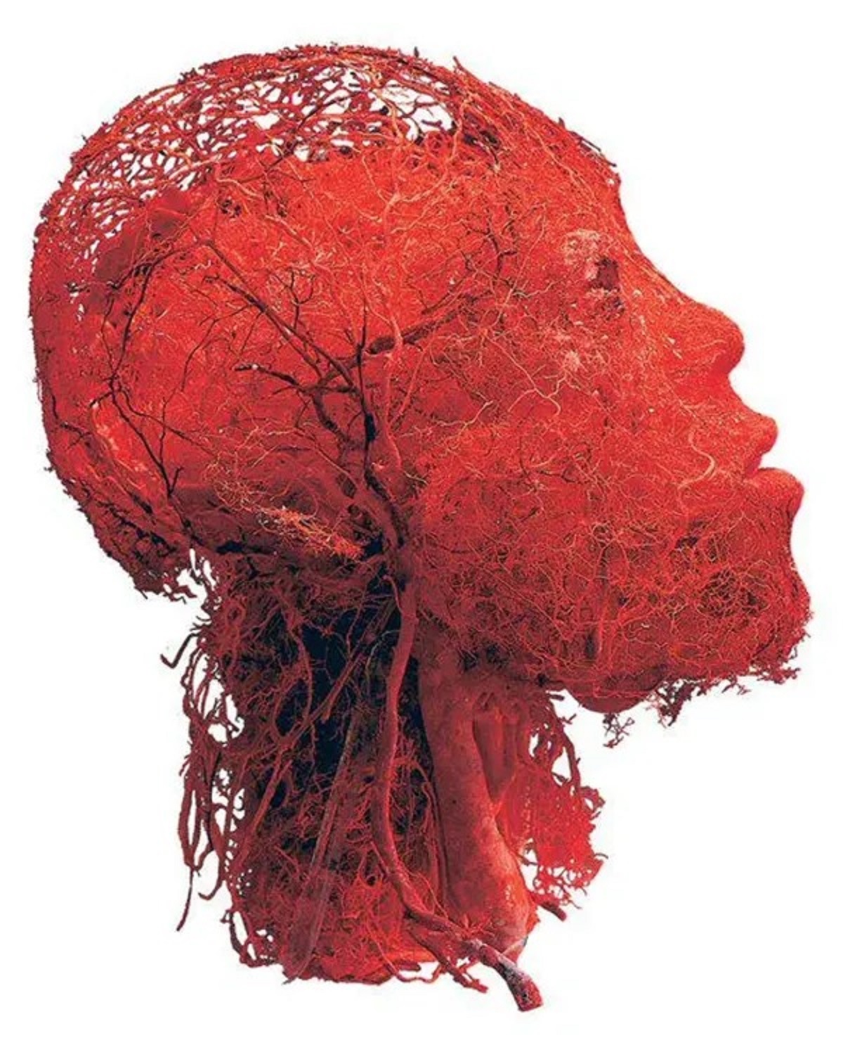 Visualization of blood vessels in brain and head.