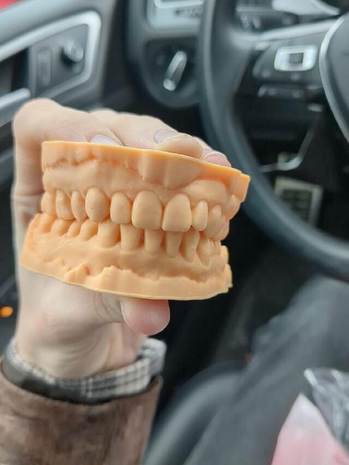 "My dentist let me keep the 3D printed model of my teeth they used to make a night guard"