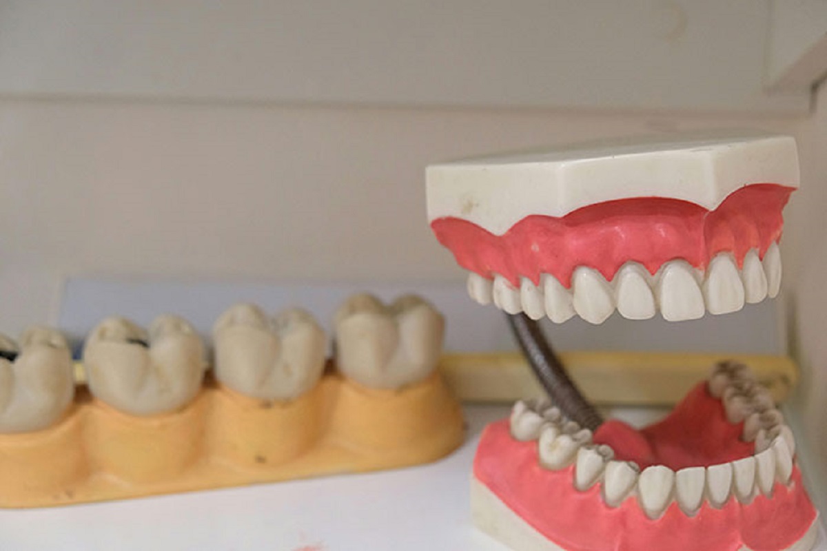 In the 1800s a LOT of dentures were made using the teeth of dead soldiers.