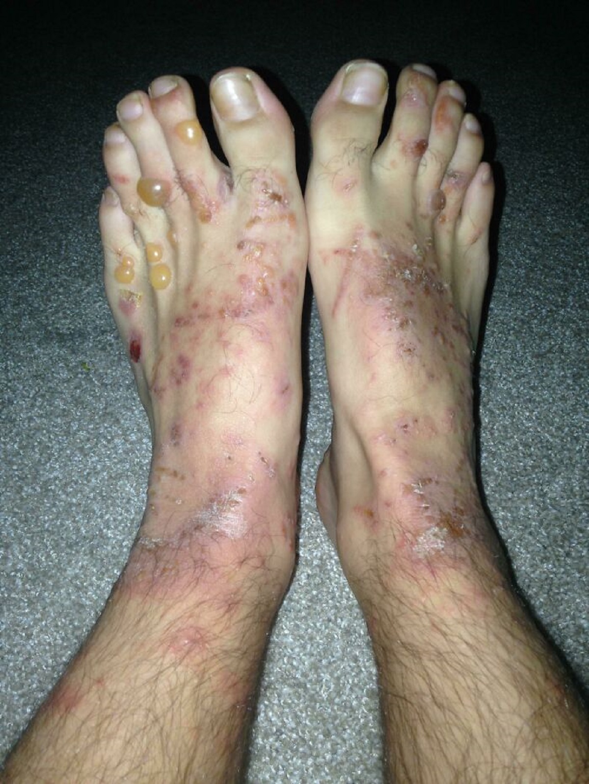 Don’t Run Barefoot In The Peruvian Jungle, Folks