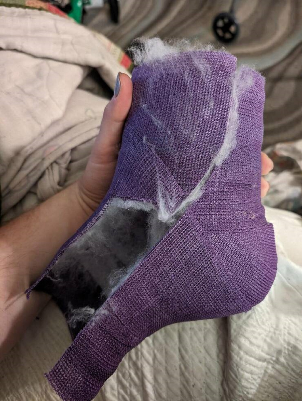 "The angle of my foot in my cast (45 instead of 90)"
