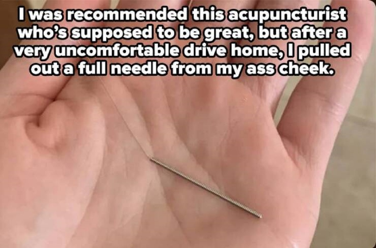 photo caption - I was recommended this acupuncturist who's supposed to be great, but after a very uncomfortable drive home, I pulled out a full needle from my ass cheek.