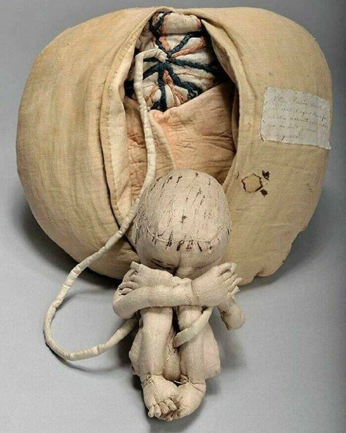 "A Fabric Womb Made By Angélique Du Coudray, A French Midwife Who Was Commissioned By King Louis Xv To Reduce Infant Mortality"