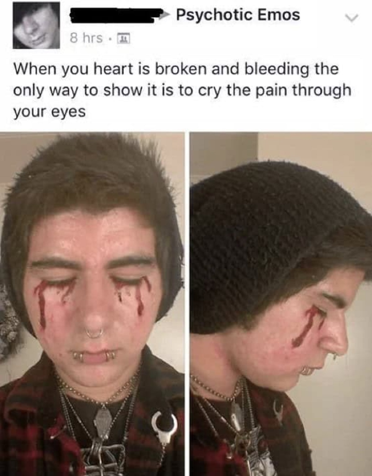 photo caption - C 8 hrs m Psychotic Emos When you heart is broken and bleeding the only way to show it is to cry the pain through your eyes