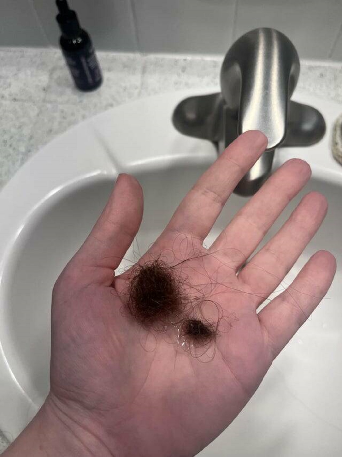"How much hair I’m losing per day"