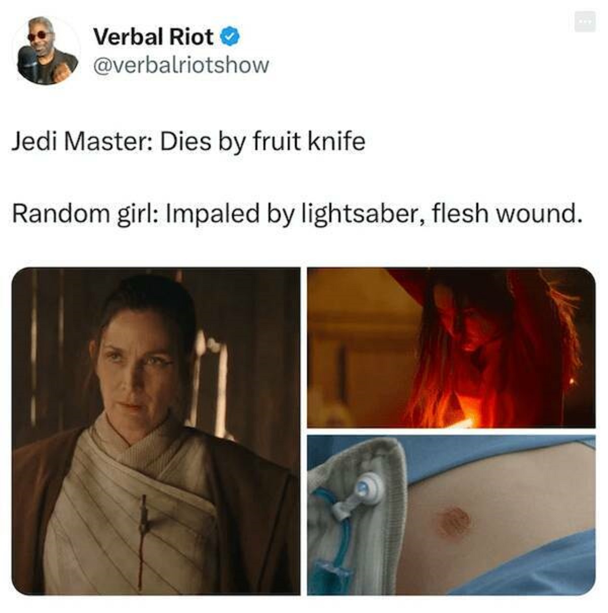 medical equipment - Verbal Riot Jedi Master Dies by fruit knife Random girl Impaled by lightsaber, flesh wound.