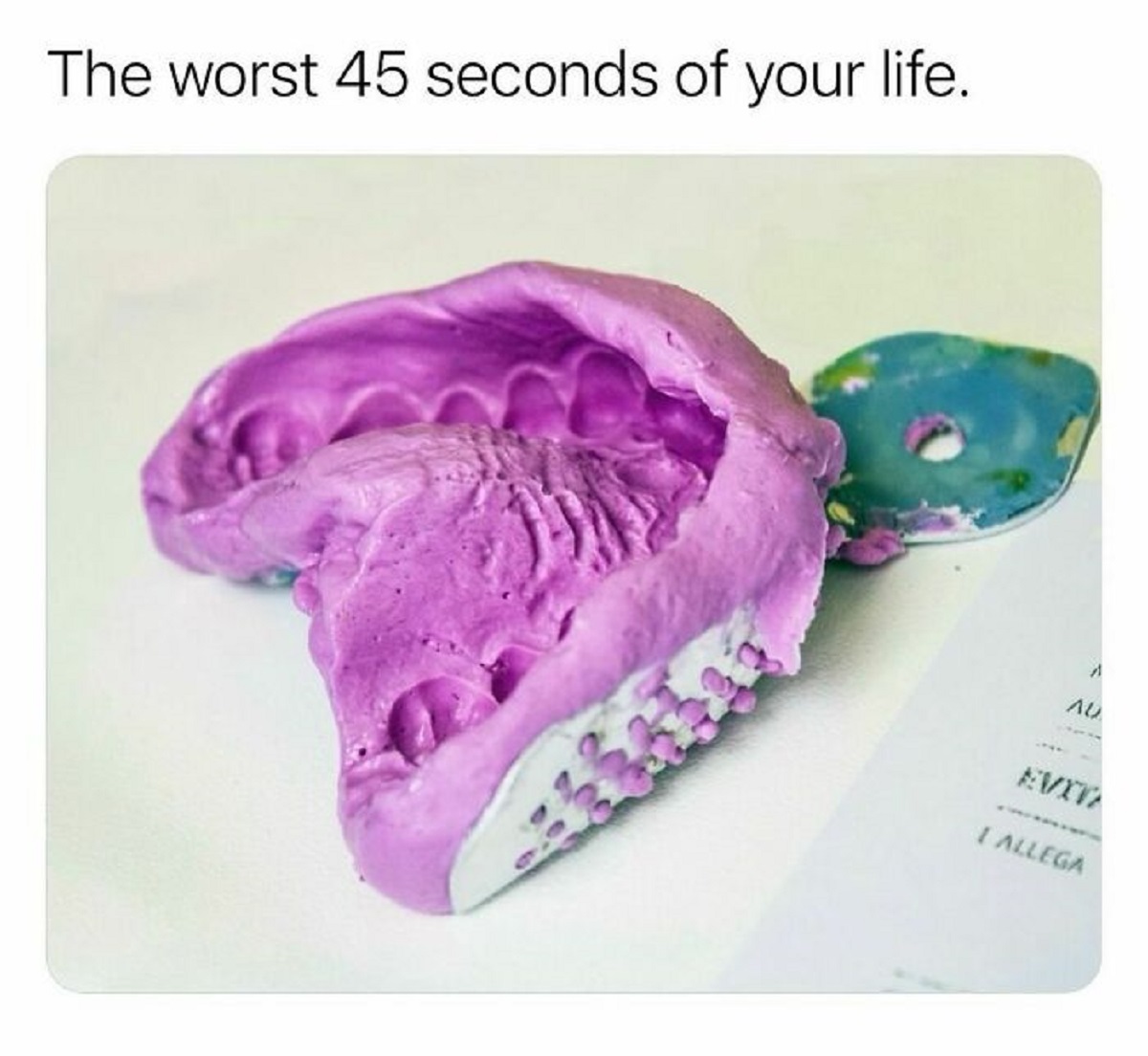 Dentistry - The worst 45 seconds of your life. A Au Evita I Allega