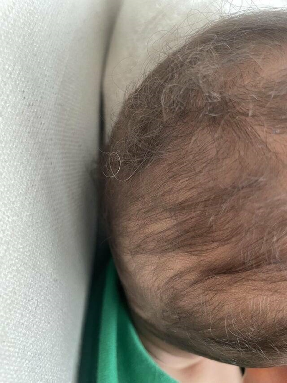 "My 1yr old son has a single grey hair"