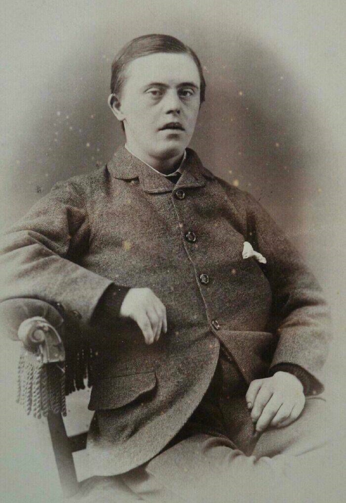 "Man With Down’s Syndrome, 1890s"