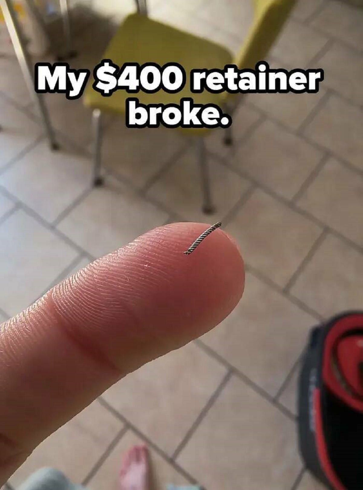 photo caption - My $400 retainer broke.