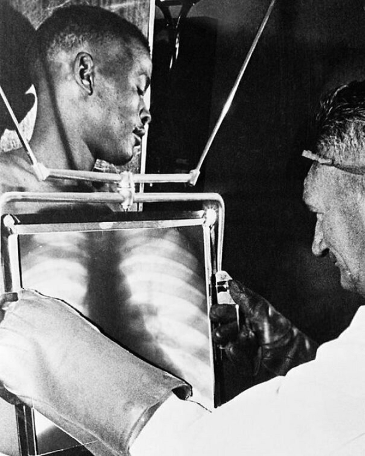 De Beer Mine Worker Is X-Rayed At The End Of His Shift Before Leaving The Diamond Mines. In Kimberley, South Africa, October 1954