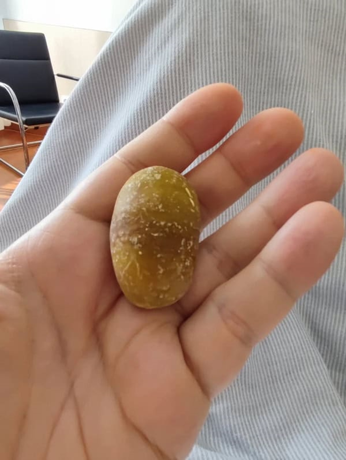 “One of the gallstones that was removed with my gallbladder yesterday”