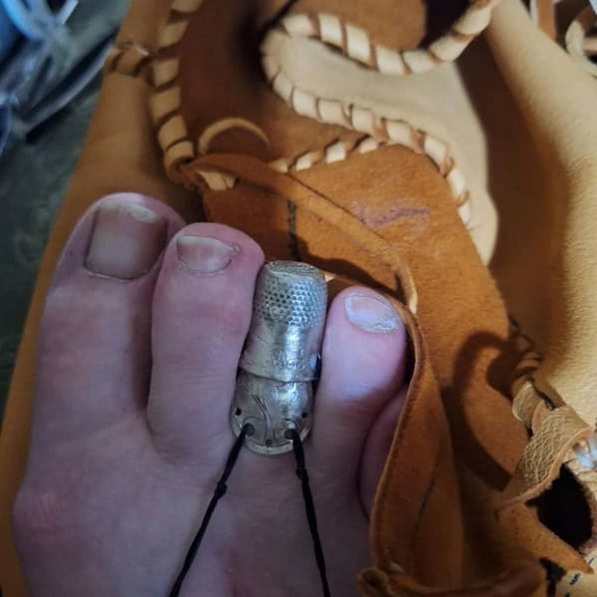 “My mom’s homemade toe prosthetic”