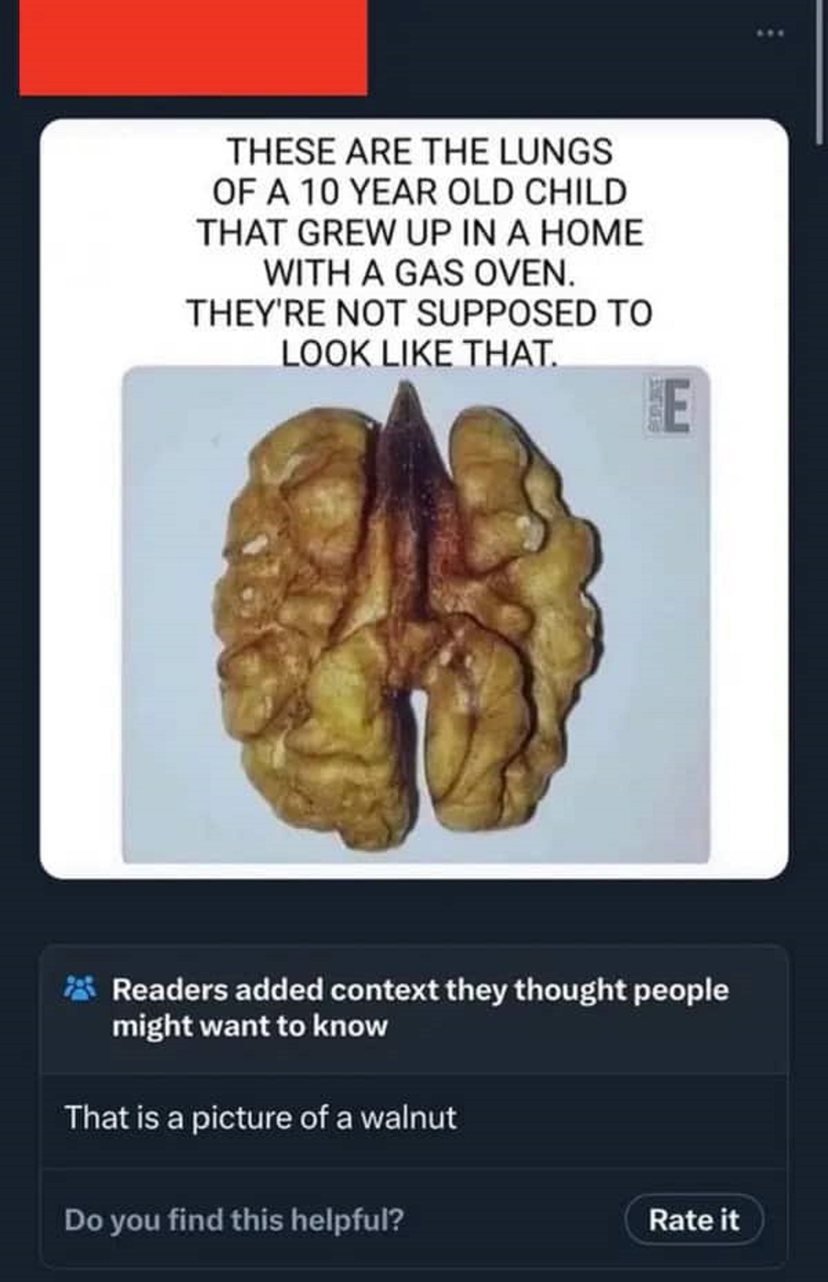 community notes funny - These Are The Lungs Of A 10 Year Old Child That Grew Up In A Home With A Gas Oven. They'Re Not Supposed To Look That. Readers added context they thought people might want to know That is a picture of a walnut Do you find this helpf