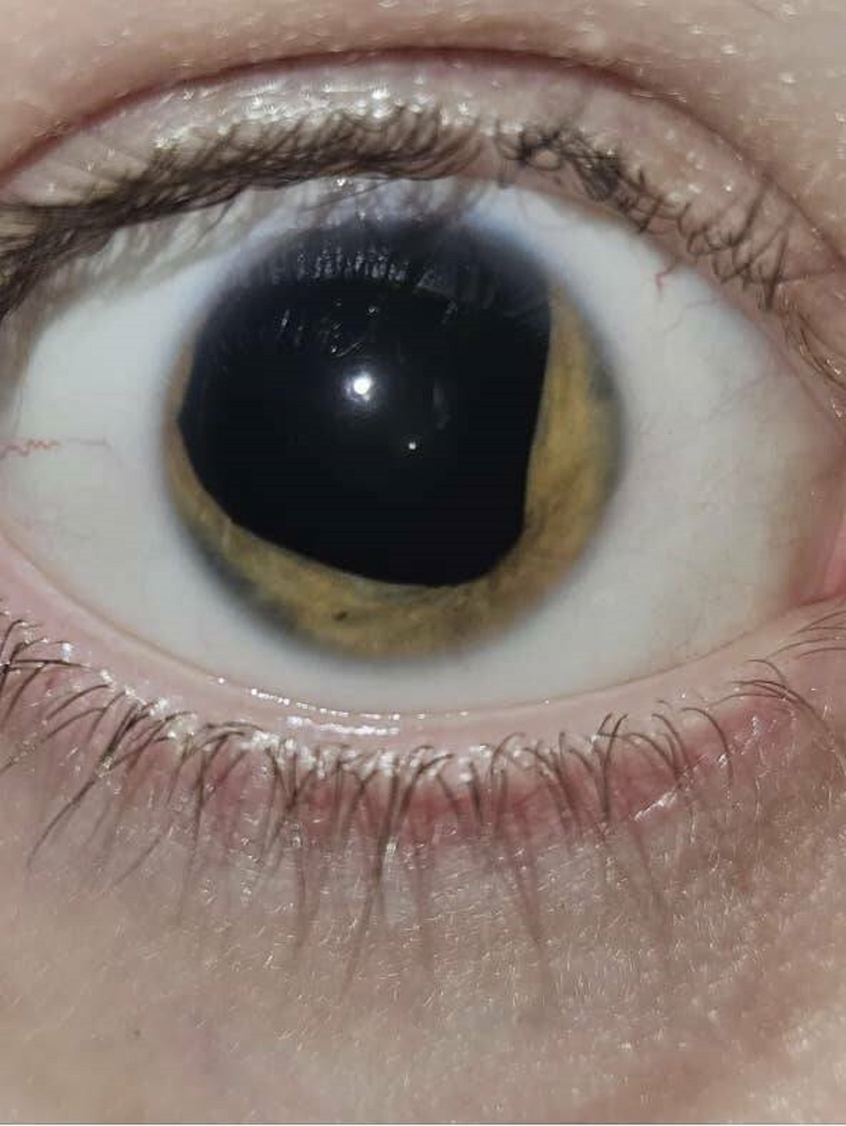 This person's pupil that my pupils cannot stop staring at: