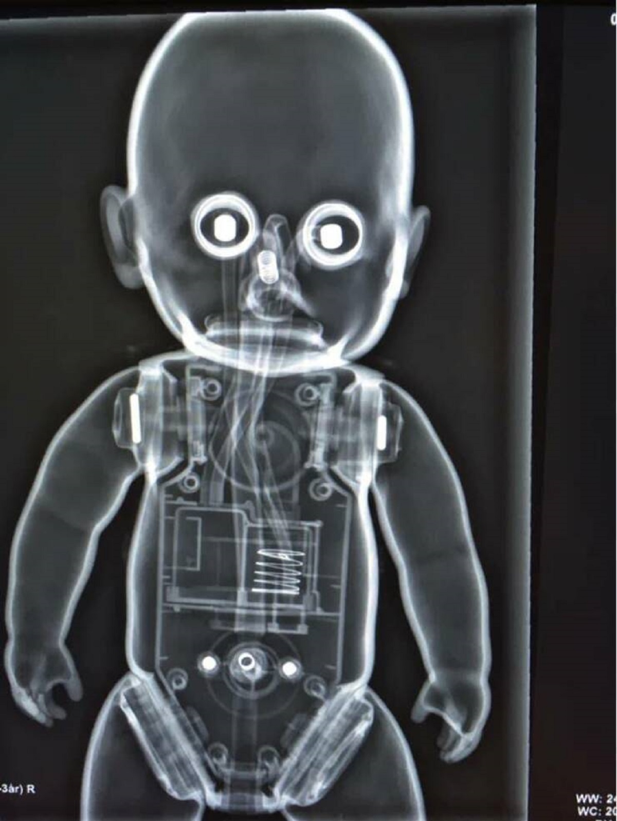 This absolutely unnerving X-ray of a kid’s doll that looks like it’s staring into my very soul and is 0.0005 seconds away from possessing me, probably: