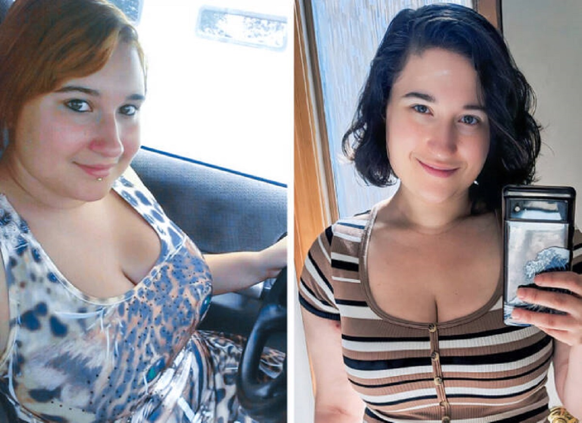 “This is me at 18 before I was diagnosed with diabetes, and at 30 when I got it under control.”