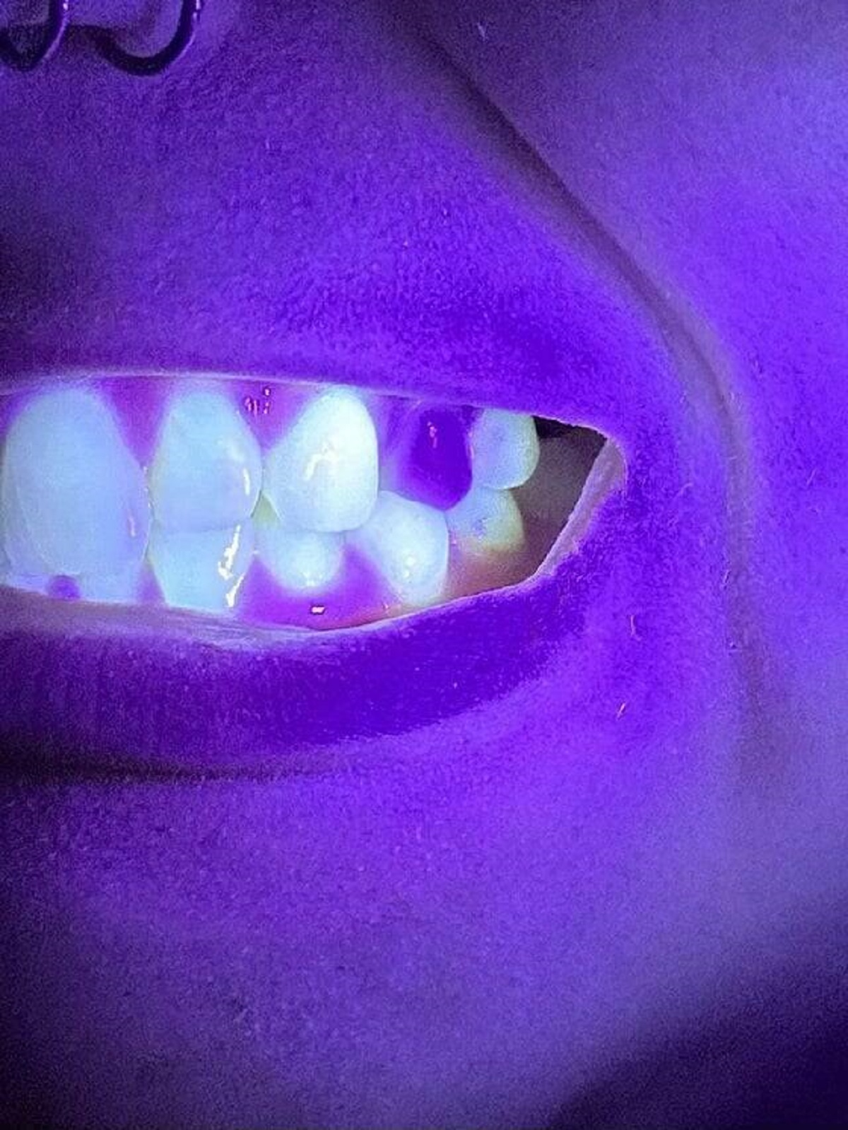 "Fake teeth don’t glow under black light, real teeth do."